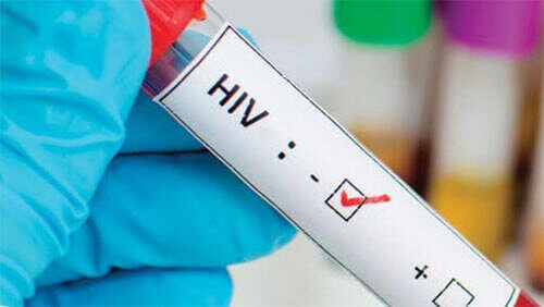 анализ крови на ВИЧ анонимно